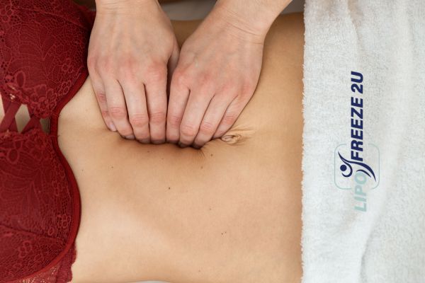 diastasis recti treatment Maidenhead