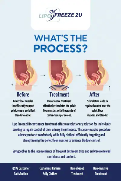 Diagram of how incontinence treatment Maidenhead works.