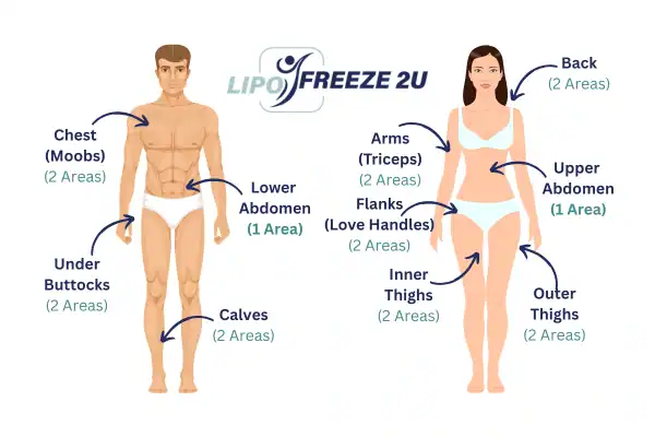 Areas you can have fat freezing treatment Maidenhead