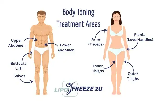 Graphic showing where you can have Body toning Treatment Maidenhead on your body