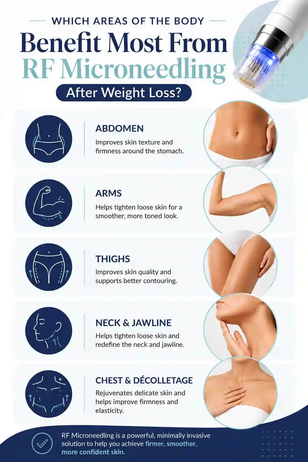 Which Areas of the Body Benefit Most From RF Microneedling After Weight Loss Maidenhead